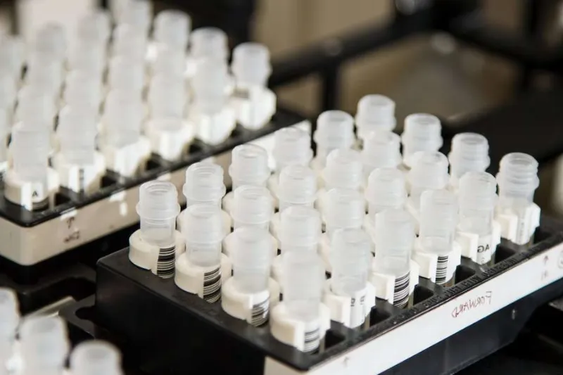 Les particularités des tests d'ADN autosomique